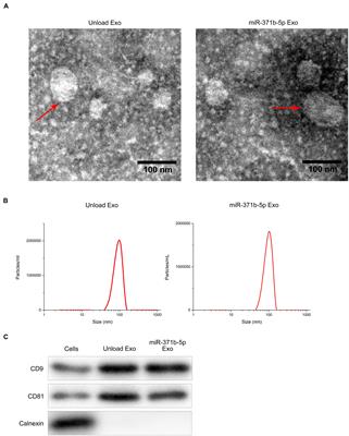 miR-371b-5p-Engineered Exosomes Enhances Tumor Inhibitory Effect